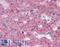 APR antibody, LS-B2342, Lifespan Biosciences, Immunohistochemistry paraffin image 