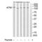 Atrophin 1 antibody, A03828, Boster Biological Technology, Western Blot image 