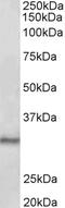 G Protein-Coupled Receptor 83 antibody, 42-936, ProSci, Western Blot image 