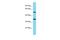 Pancreatic Lipase Related Protein 3 antibody, A17011, Boster Biological Technology, Western Blot image 