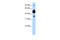 Adenosine monophosphate-protein transferase FICD antibody, 30-238, ProSci, Enzyme Linked Immunosorbent Assay image 