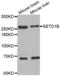 SET Domain Containing 1B, Histone Lysine Methyltransferase antibody, abx001870, Abbexa, Western Blot image 