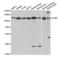 SH2B Adaptor Protein 1 antibody, LS-C334143, Lifespan Biosciences, Western Blot image 