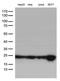 O-6-Methylguanine-DNA Methyltransferase antibody, LS-C794744, Lifespan Biosciences, Western Blot image 
