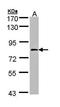Coagulation Factor XIII A Chain antibody, orb74116, Biorbyt, Western Blot image 