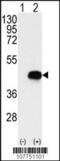 Branched Chain Keto Acid Dehydrogenase Kinase antibody, 62-669, ProSci, Western Blot image 