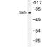 SIX Homeobox 5 antibody, LS-C177463, Lifespan Biosciences, Western Blot image 