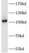 Spalt Like Transcription Factor 2 antibody, FNab07582, FineTest, Western Blot image 
