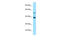 Tripartite Motif Containing 7 antibody, ARP43374_P050, Aviva Systems Biology, Western Blot image 