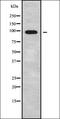 ATP Binding Cassette Subfamily B Member 11 antibody, orb338074, Biorbyt, Western Blot image 