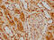 Histone Deacetylase 9 antibody, CSB-RA010245A0HU, Cusabio, Immunohistochemistry frozen image 