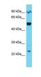 Archaelysin Family Metallopeptidase 2 antibody, orb330832, Biorbyt, Western Blot image 