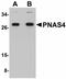 Desumoylating Isopeptidase 2 antibody, LS-C108460, Lifespan Biosciences, Western Blot image 