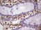 Peripherin antibody, LS-C339865, Lifespan Biosciences, Immunohistochemistry paraffin image 