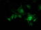 Protein Kinase CAMP-Dependent Type I Regulatory Subunit Beta antibody, M07227, Boster Biological Technology, Immunofluorescence image 