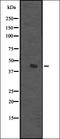 Membrane Palmitoylated Protein 1 antibody, orb337156, Biorbyt, Western Blot image 