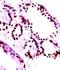 Phosphatase And Tensin Homolog antibody, TA354759, Origene, Western Blot image 