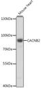 Calcium Voltage-Gated Channel Auxiliary Subunit Beta 2 antibody, 16-389, ProSci, Western Blot image 