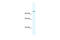 Forkhead Box P4 antibody, 28-666, ProSci, Western Blot image 