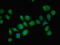 Phosphatidylinositol-5-Phosphate 4-Kinase Type 2 Beta antibody, LS-C376324, Lifespan Biosciences, Immunofluorescence image 