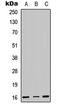 Centromere Protein A antibody, LS-C354603, Lifespan Biosciences, Western Blot image 