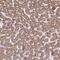 Acyl-CoA Synthetase Medium Chain Family Member 2A antibody, PA5-63470, Invitrogen Antibodies, Immunohistochemistry paraffin image 