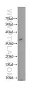 TNF Receptor Superfamily Member 13B antibody, 21520-1-AP, Proteintech Group, Western Blot image 
