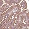 Ras Association Domain Family Member 1 antibody, NBP1-89411, Novus Biologicals, Immunohistochemistry paraffin image 