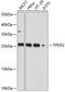 Tumor protein D52 antibody, 13-535, ProSci, Western Blot image 