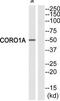 Coronin 1A antibody, TA326236, Origene, Western Blot image 
