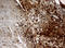 Thymidine Phosphorylase antibody, LS-C175523, Lifespan Biosciences, Immunohistochemistry paraffin image 