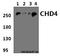 Chromodomain Helicase DNA Binding Protein 4 antibody, A01125-1, Boster Biological Technology, Western Blot image 