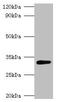 Glutaminase 1 antibody, orb240592, Biorbyt, Western Blot image 