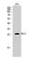 BCL2 antibody, STJ91835, St John