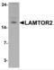 Late Endosomal/Lysosomal Adaptor, MAPK And MTOR Activator 2 antibody, NBP2-81696, Novus Biologicals, Western Blot image 