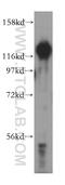 HDGF Like 2 antibody, 15134-1-AP, Proteintech Group, Western Blot image 