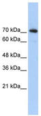 Sterol Regulatory Element Binding Transcription Factor 2 antibody, TA330045, Origene, Western Blot image 