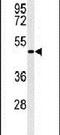 GATA Binding Protein 6 antibody, PA5-24794, Invitrogen Antibodies, Western Blot image 