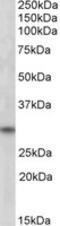 Four And A Half LIM Domains 3 antibody, MBS421896, MyBioSource, Western Blot image 