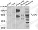 Feline Leukemia Virus Subgroup C Cellular Receptor Family Member 2 antibody, A7815, ABclonal Technology, Western Blot image 