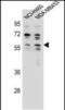 Ankyrin Repeat Domain 34C antibody, PA5-48289, Invitrogen Antibodies, Western Blot image 
