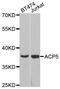 Acid Phosphatase 5, Tartrate Resistant antibody, orb153703, Biorbyt, Western Blot image 