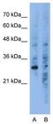 WDVCF antibody, GTX47168, GeneTex, Western Blot image 