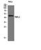 TATA box-binding protein-like protein 2 antibody, STJ95928, St John