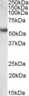 Keratin 13 antibody, LS-B3608, Lifespan Biosciences, Western Blot image 