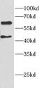 ETS Transcription Factor ELK1 antibody, FNab02738, FineTest, Western Blot image 