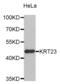 Keratin 23 antibody, abx002053, Abbexa, Western Blot image 