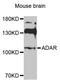 Adenosine Deaminase RNA Specific antibody, A00869, Boster Biological Technology, Western Blot image 