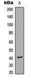 Calcium/Calmodulin Dependent Protein Kinase I antibody, LS-C354567, Lifespan Biosciences, Western Blot image 