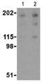 Reticulon 4 antibody, ab62024, Abcam, Western Blot image 